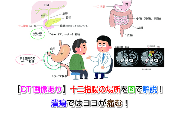 【CT画像あり】十二指腸の場所を図で解説！潰瘍ではココが痛む！