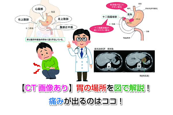 【CT画像あり】胃の場所を図で解説！痛みが出るのはココ！
