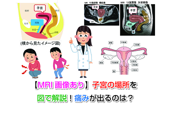 【MRI画像あり】子宮の場所を図で解説！痛みが出るのは？