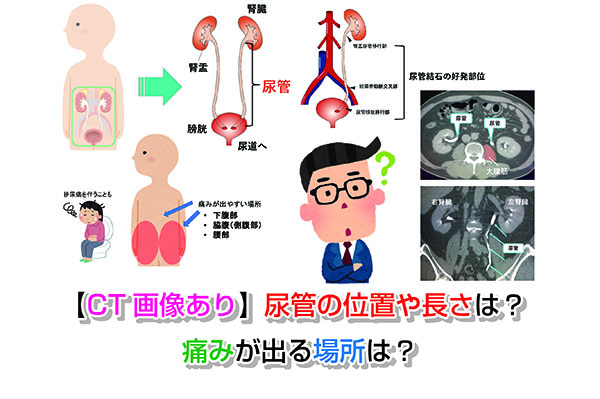 【CT画像あり】尿管の位置や長さは？痛みが出る場所は？
