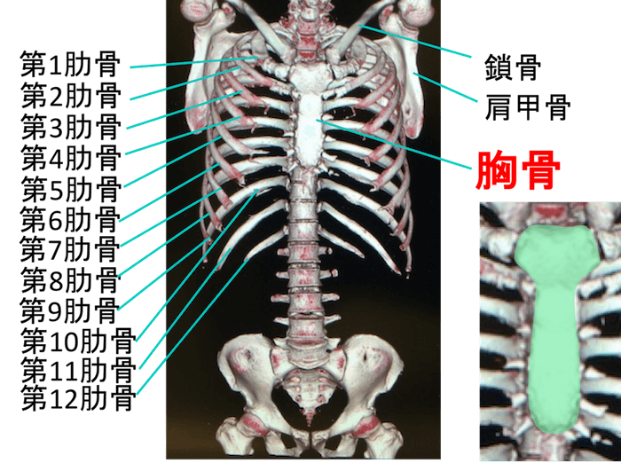 胸骨の3DCT再構成像での場所
