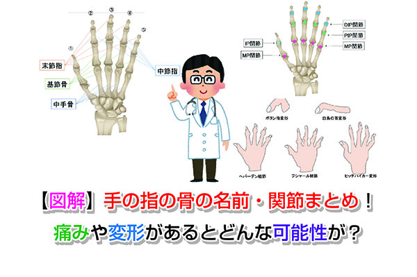 【図解】手の指の骨の名前・関節まとめ！痛みや変形があるとどんな可能性が？
