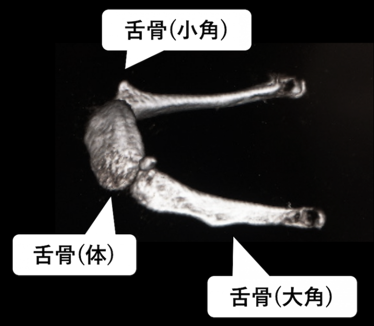 【CT画像あり】舌骨の位置・解剖・役割を徹底まとめ!