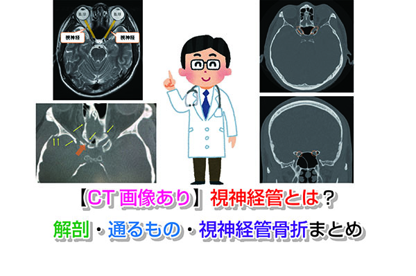 【CT画像あり】視神経管とは？解剖・通るもの・視神経管骨折まとめ