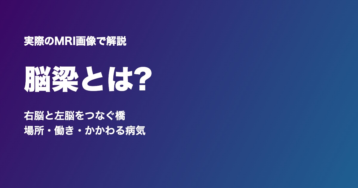 脳梁とは